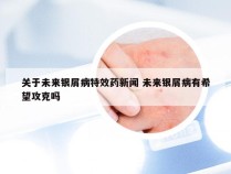 关于未来银屑病特效药新闻 未来银屑病有希望攻克吗