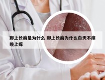 脚上长癣是为什么 脚上长癣为什么白天不痒晚上痒