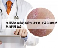 寻常型银屑病的治疗可以多选 寻常型银屑病禁用何种治疗