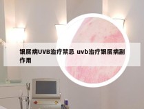 银屑病UVB治疗禁忌 uvb治疗银屑病副作用