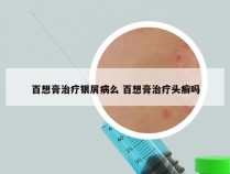 百想膏治疗银屑病么 百想膏治疗头癣吗