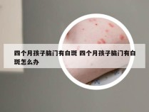 四个月孩子脑门有白斑 四个月孩子脑门有白斑怎么办