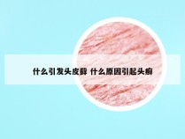 什么引发头皮藓 什么原因引起头癣