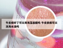 牛皮癣好了可以用海藻面膜吗 牛皮肤癣可以洗海水澡吗