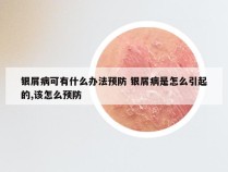 银屑病可有什么办法预防 银屑病是怎么引起的,该怎么预防