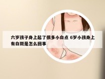 六岁孩子身上起了很多小白点 6岁小孩身上有白斑是怎么回事