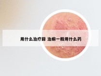 用什么治疗藓 治癣一般用什么药