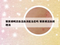 银屑病喝凉血活血汤能治愈吗 银屑病活血调理汤