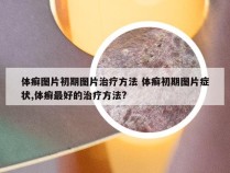 体癣图片初期图片治疗方法 体癣初期图片症状,体癣最好的治疗方法?