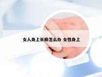 女人身上长癣怎么办 女性身上