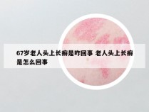 67岁老人头上长癣是咋回事 老人头上长癣是怎么回事