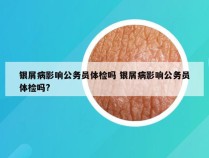 银屑病影响公务员体检吗 银屑病影响公务员体检吗?