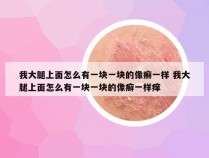 我大腿上面怎么有一块一块的像癣一样 我大腿上面怎么有一块一块的像癣一样痒