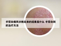 手臂白癜风诊断出来的结果是什么 手臂白斑的治疗方法