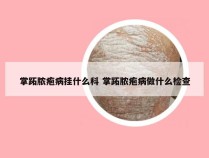 掌跖脓疱病挂什么科 掌跖脓疱病做什么检查