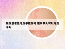 银屑患者能吃瓜子花生吗 银屑病人可以吃瓜子吗