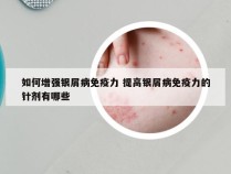 如何增强银屑病免疫力 提高银屑病免疫力的针剂有哪些