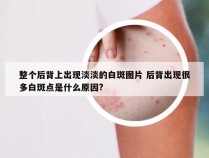 整个后背上出现淡淡的白斑图片 后背出现很多白斑点是什么原因?