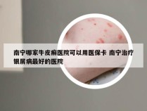 南宁哪家牛皮癣医院可以用医保卡 南宁治疗银屑病最好的医院