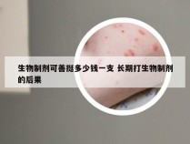 生物制剂可善挺多少钱一支 长期打生物制剂的后果