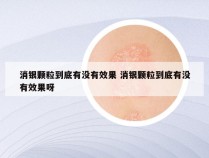 消银颗粒到底有没有效果 消银颗粒到底有没有效果呀