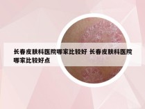 长春皮肤科医院哪家比较好 长春皮肤科医院哪家比较好点