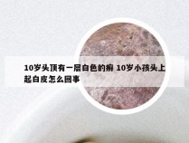 10岁头顶有一层白色的癣 10岁小孩头上起白皮怎么回事