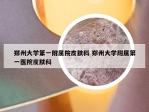 郑州大学第一附属院皮肤科 郑州大学附属第一医院皮肤科