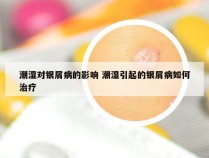 潮湿对银屑病的影响 潮湿引起的银屑病如何治疗