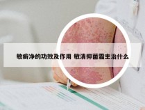 敏癣净的功效及作用 敏清抑菌霜主治什么