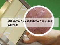 银屑病打白介23 银屑病打白介素23有什么副作用