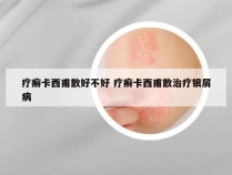 疗癣卡西甫散好不好 疗癣卡西甫散治疗银屑病