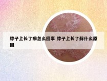 脖子上长了癣怎么回事 脖子上长了藓什么原因