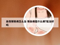 血夜银销病怎么治 银血病是什么病?能治好吗