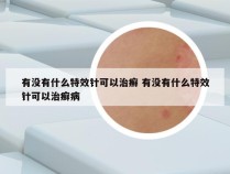 有没有什么特效针可以治癣 有没有什么特效针可以治癣病