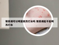 银屑病可以喝蜜桃苏打水吗 银屑病能不能喝苏打水