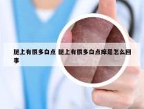 腿上有很多白点 腿上有很多白点痒是怎么回事