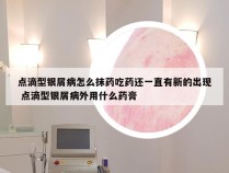 点滴型银屑病怎么抹药吃药还一直有新的出现 点滴型银屑病外用什么药膏