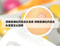 得银屑病吃药后舌头变黑 得银屑病吃药后舌头变黑怎么回事