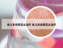 身上长白斑怎么治疗 身上长白斑怎么治疗