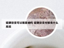 硫磺软膏可以银屑病吗 硫磺软膏对银有什么反应