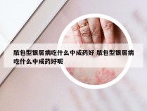 脓包型银屑病吃什么中成药好 脓包型银屑病吃什么中成药好呢