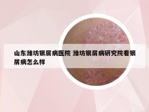 山东潍坊银屑病医院 潍坊银屑病研究院看银屑病怎么样