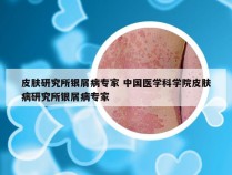 皮肤研究所银屑病专家 中国医学科学院皮肤病研究所银屑病专家