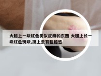 大腿上一块红色类似皮癣的东西 大腿上长一块红色斑块,摸上去有粗糙感