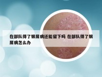 在部队得了银屑病还能留下吗 在部队得了银屑病怎么办