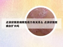 点滴状银屑病跟免疫力有关系么 点滴状银屑病会扩大吗