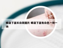 眼袋下面长白斑图片 眼袋下面有白色一块一块