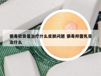 狼毒软膏是治疗什么皮肤问题 狼毒抑菌乳膏治什么