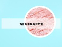 为什么牛皮癣会严重